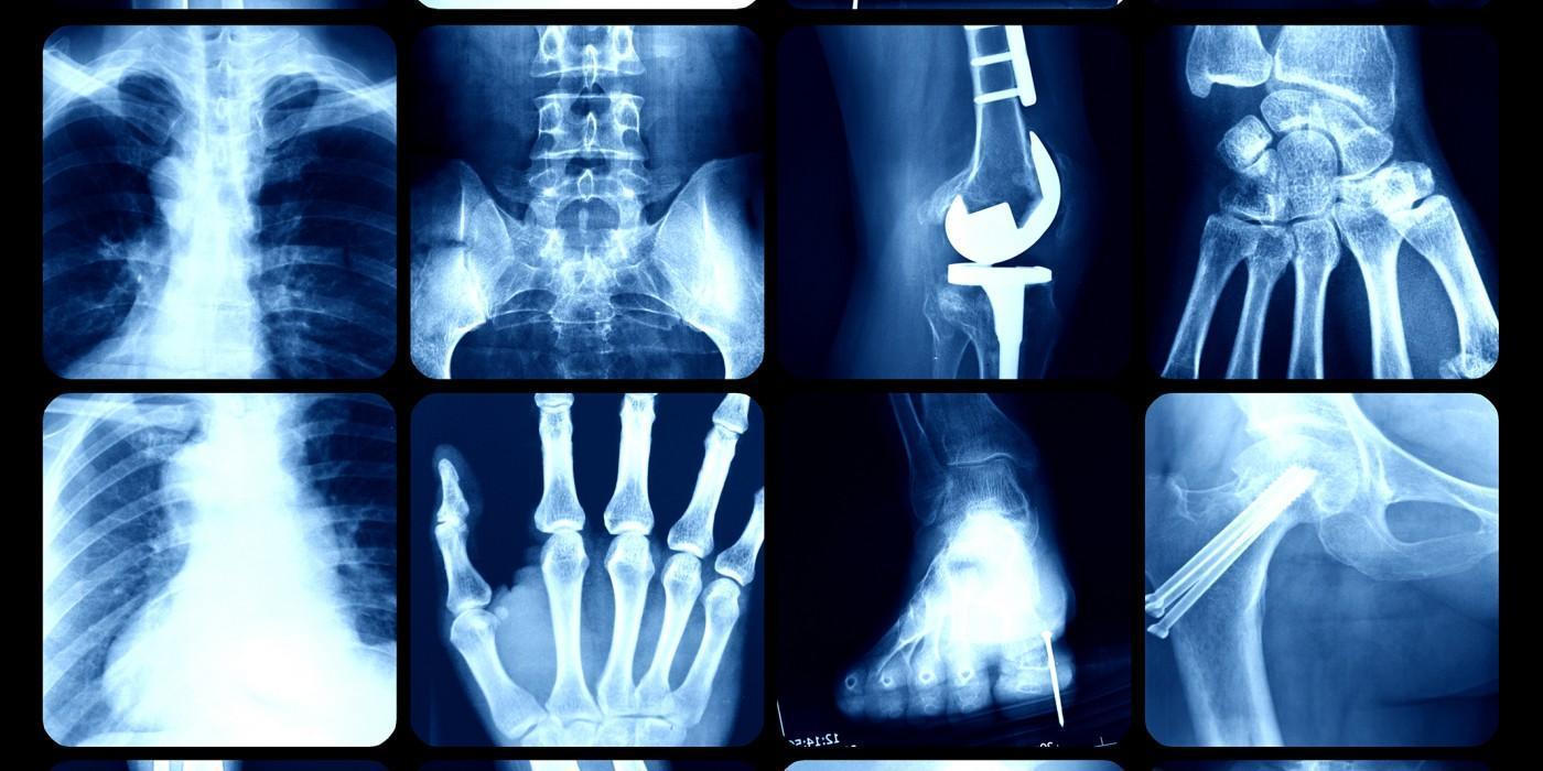 Course image for Orthopaedics MSc