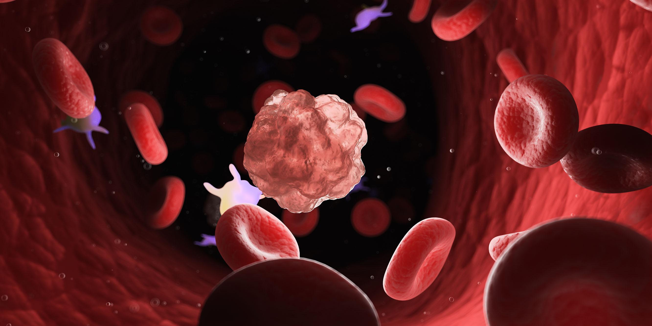 Course image for Haematology MSc
